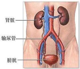 膀胱炎怎么治疗？